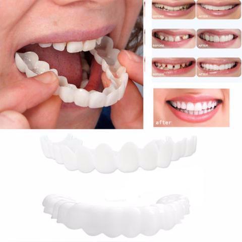 Instant Perfect Smile Upper & Lower Clip/Snap On Veneers for Perfect Teeth