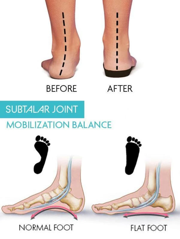 Orthopedic Bunion Corrector 2.0
