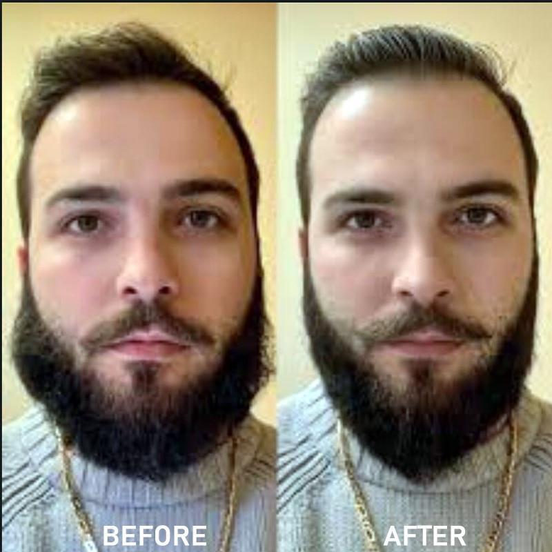 Professional Heated Beard Straightener Comb & Hair Styler - Heated Beard Prick