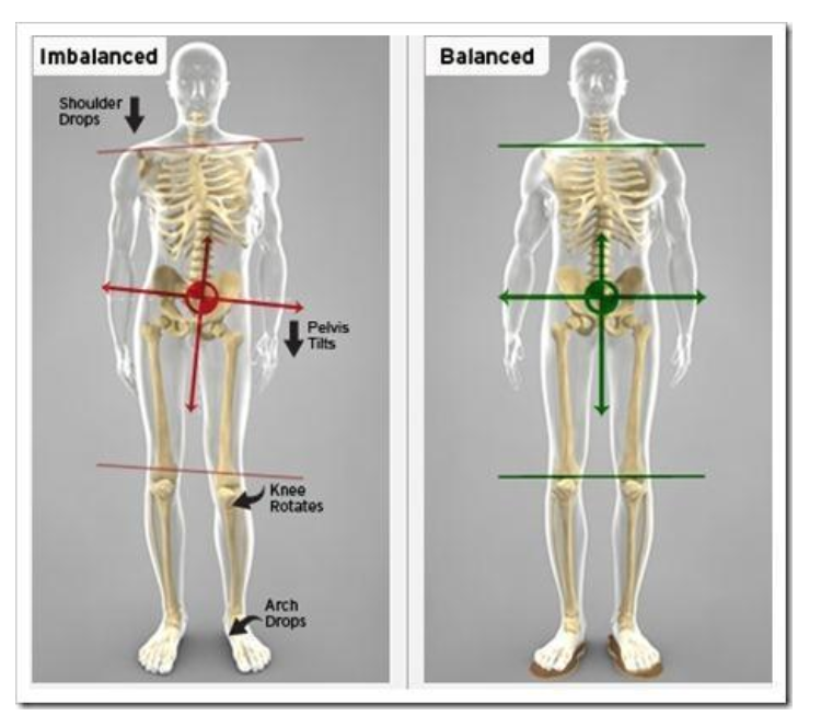 Anti - Bunion Split Platforms