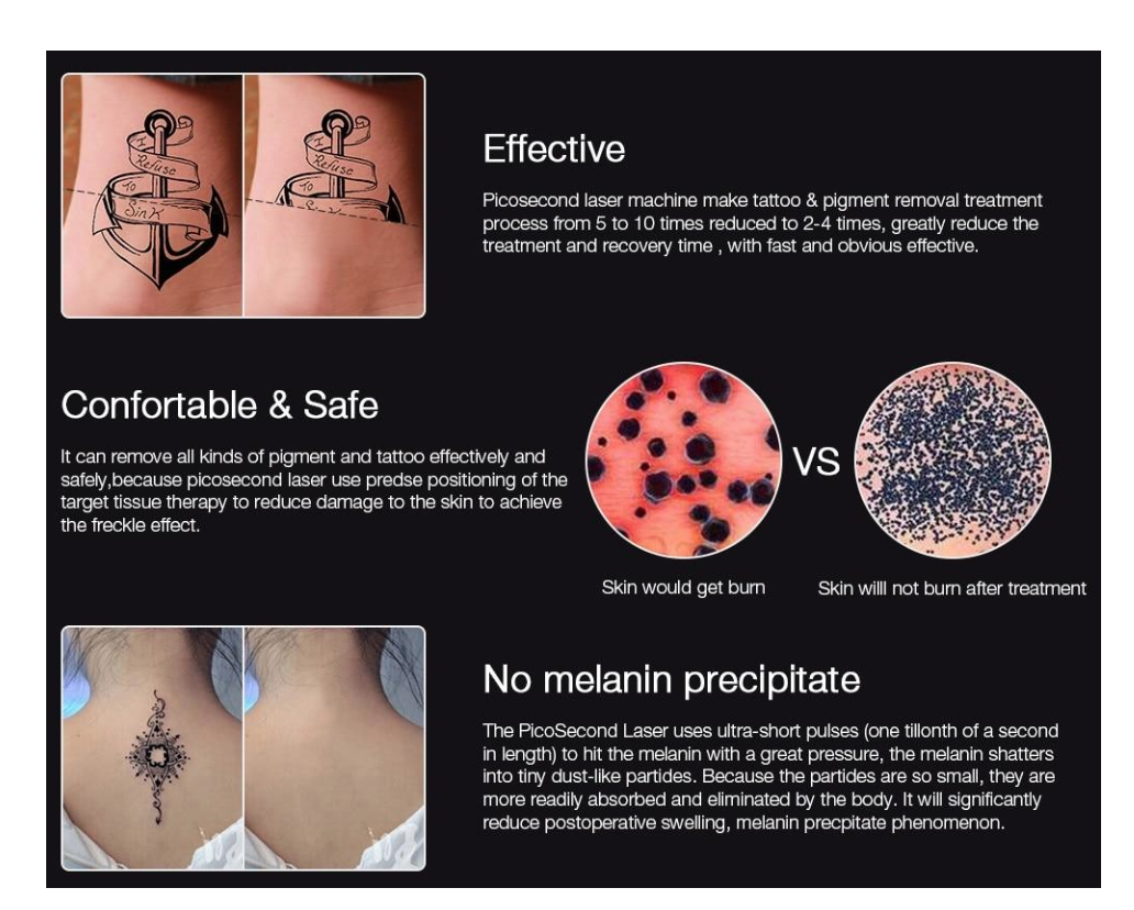 Professional Picosecond Laser Pen For Freckle Tattoo Mole Melanin Acne Removal
