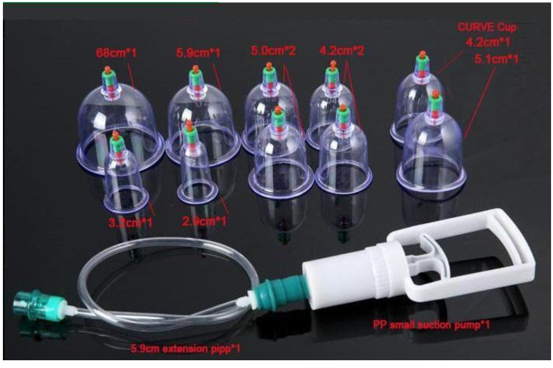 Suction Cup Therapy