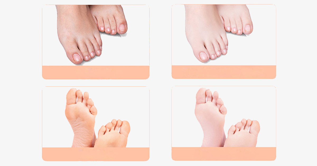Baby Foot Exfoliating Mask (1 Pack)