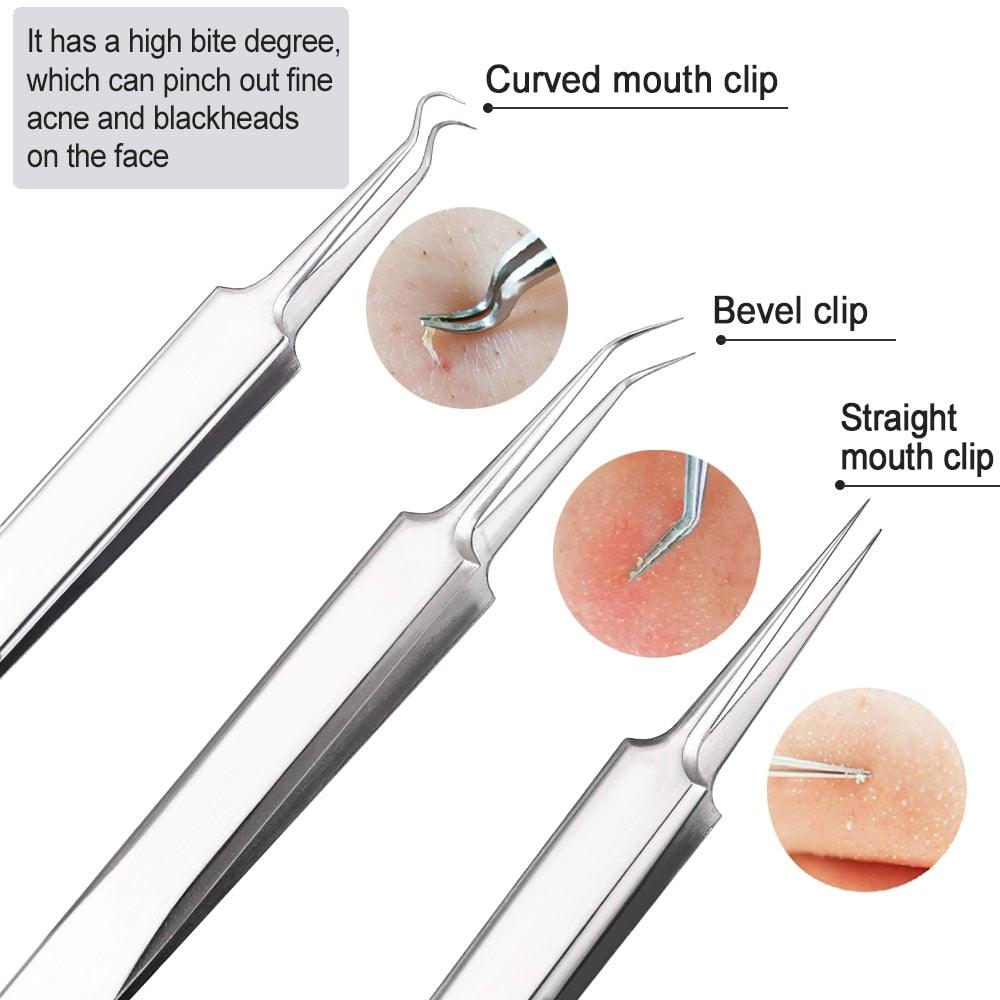 Blackhead and Acne Remover Skin Tools