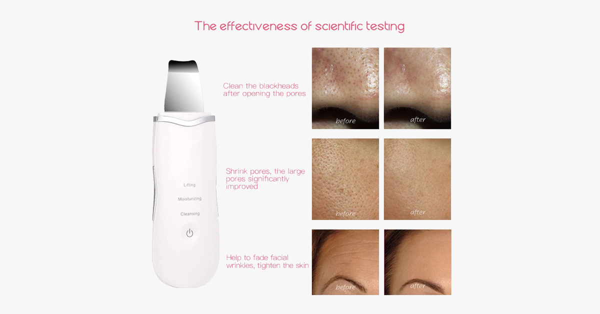 Ultrasonic Face Scrubber