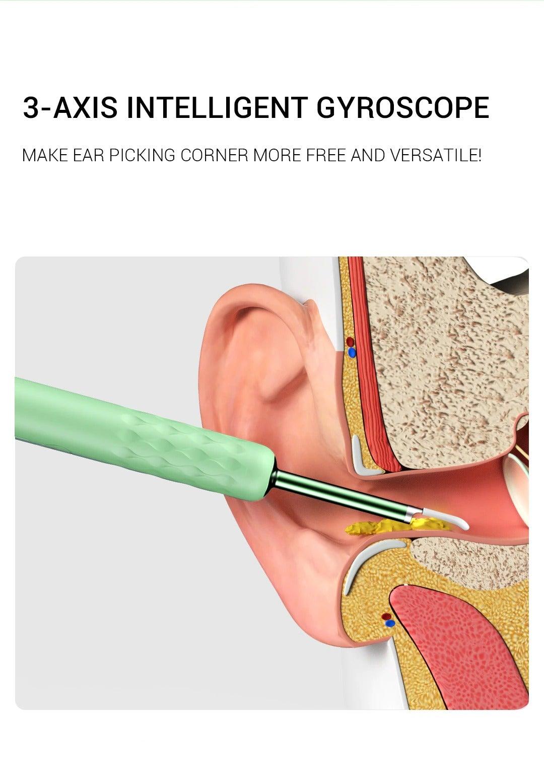 Smart Visual Endoscope