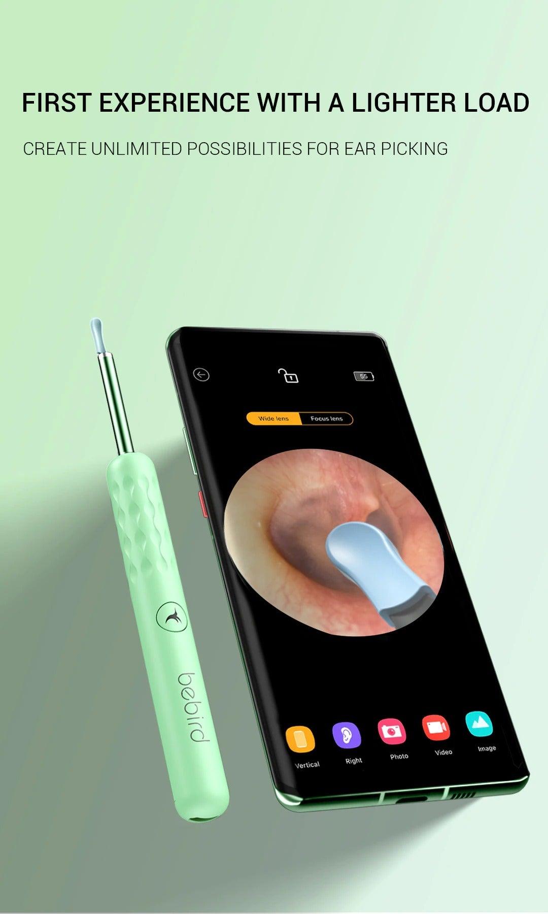 Smart Visual Endoscope